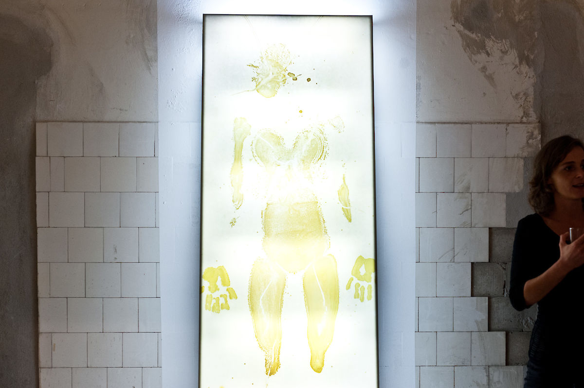 20120929_Mutation_ALB_167